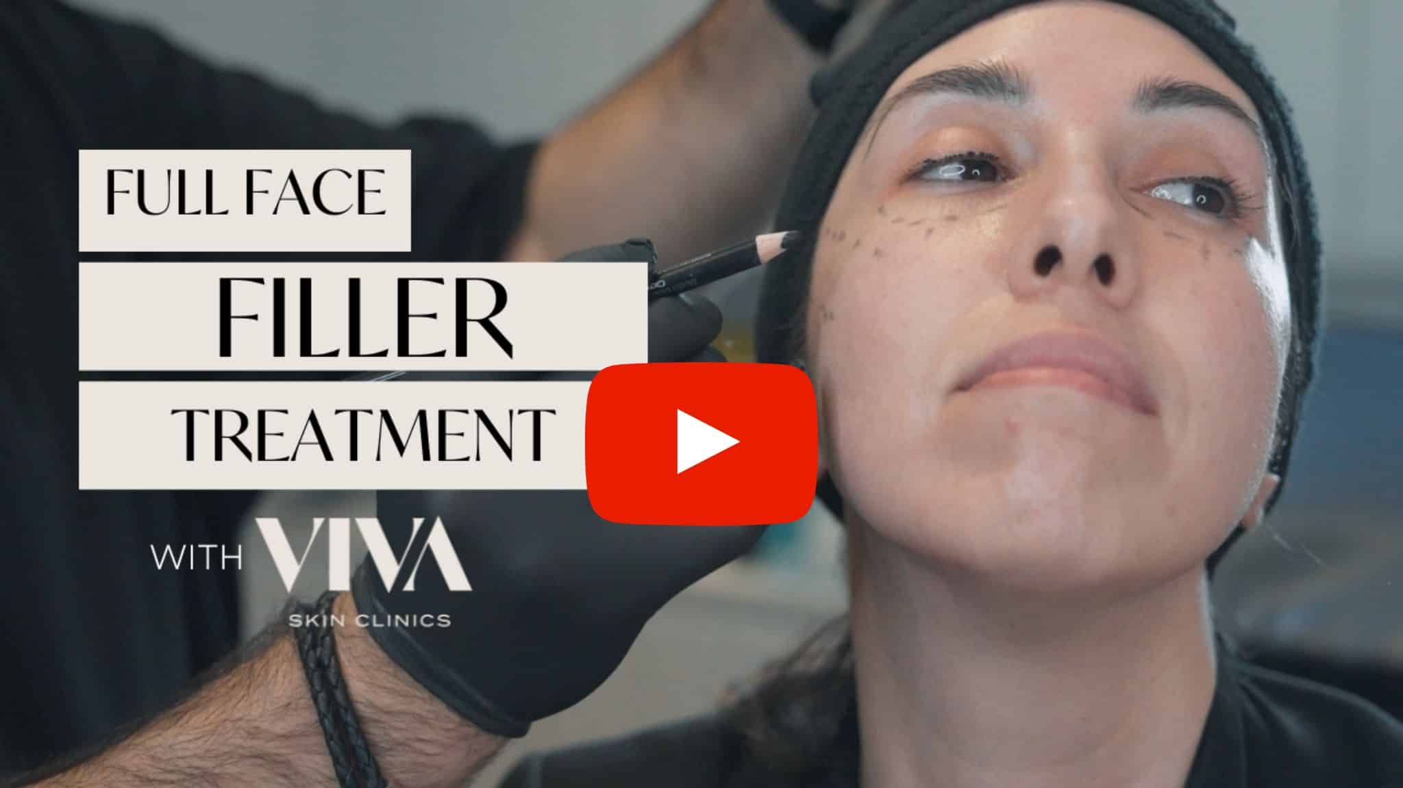 Dermal Filler Treatment Video