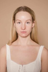 Home 3 Chemical Peels at Viva