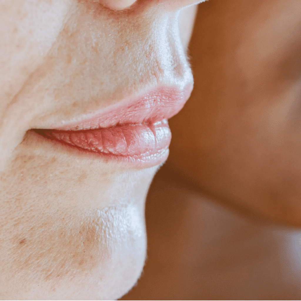 Condition-Thin-Lips-at-Viva