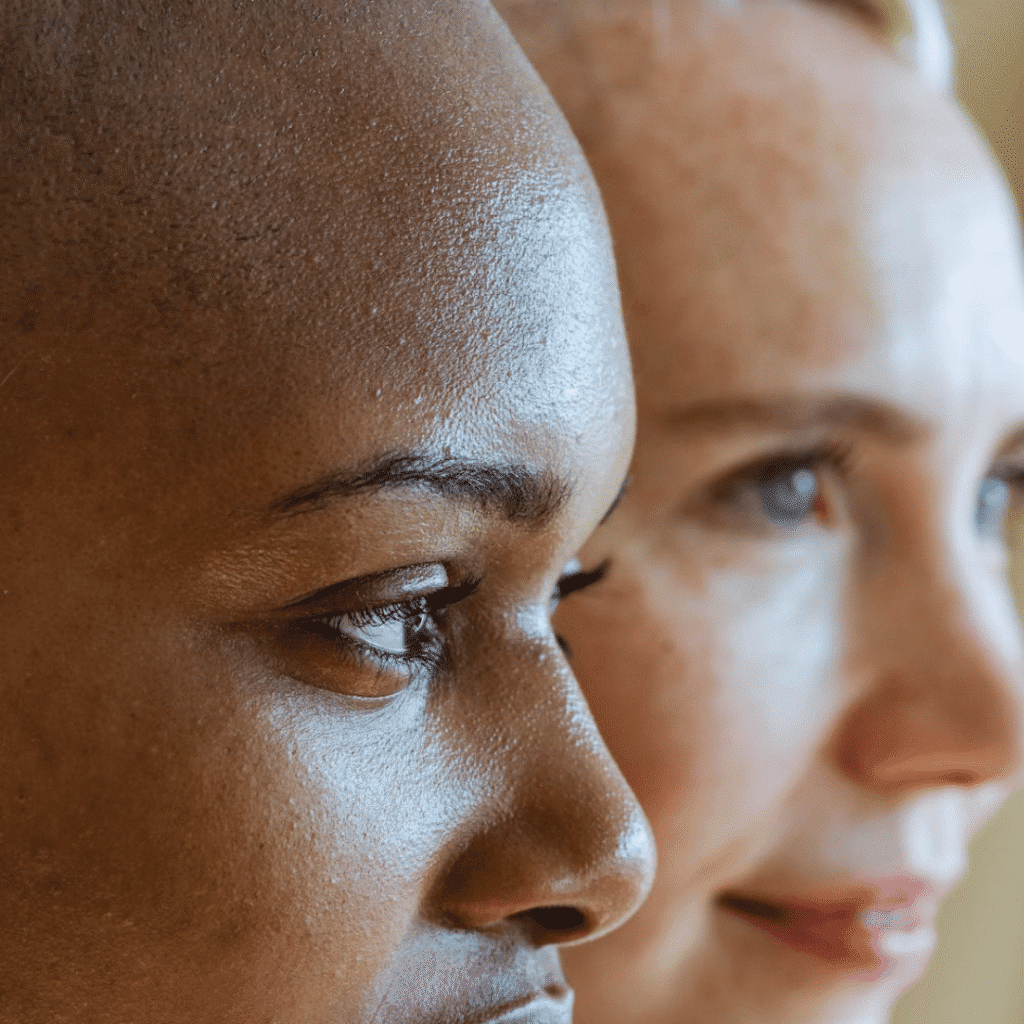 Treatment-forehead-lines-at-viva